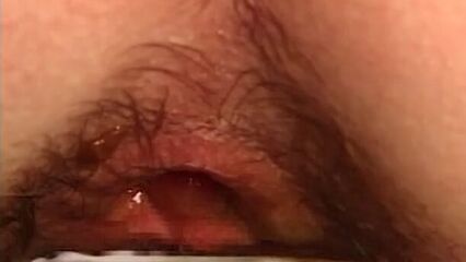 Эндоскоп в заднем проходе русских девушек