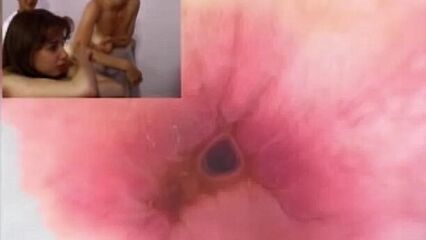 Эндоскоп в заднем проходе русских девушек